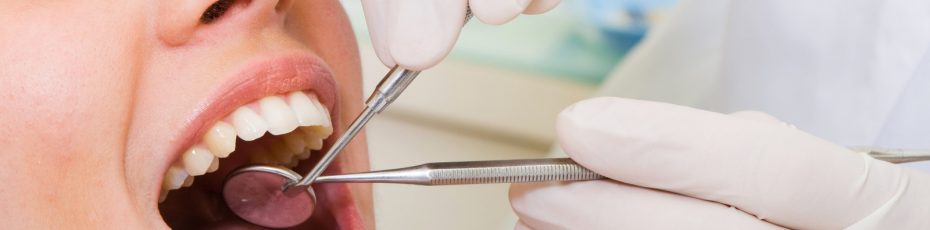 what you need to know about teeth cleaning