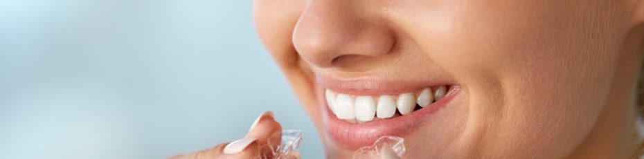 amazing things you didn't know about invisalign